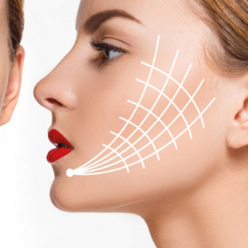 Das Fadenlifting ist die moderne Alternative zum klassischen Facelift – ganz ohne Operation. Mit innovativen, resorbierbaren PDO - Fäden.